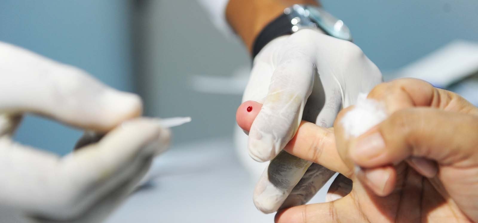 Mutirão, no sábado, fará testes de Hepatite C