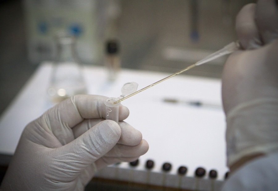 Pesquisador da USP descobre antibiótico que age contra o Parkinson