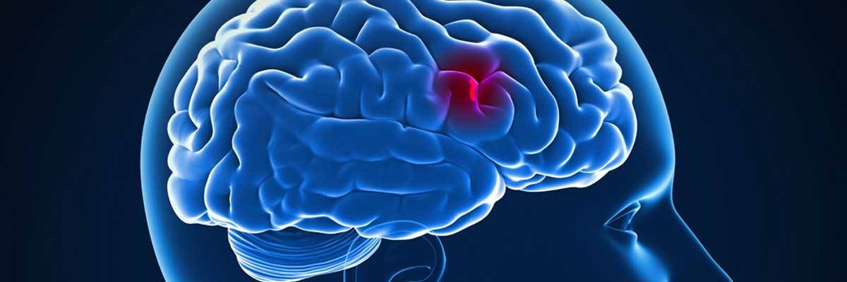 Hospital das Clínicas passa a utilizar novo método para atendimento em casos de AVC