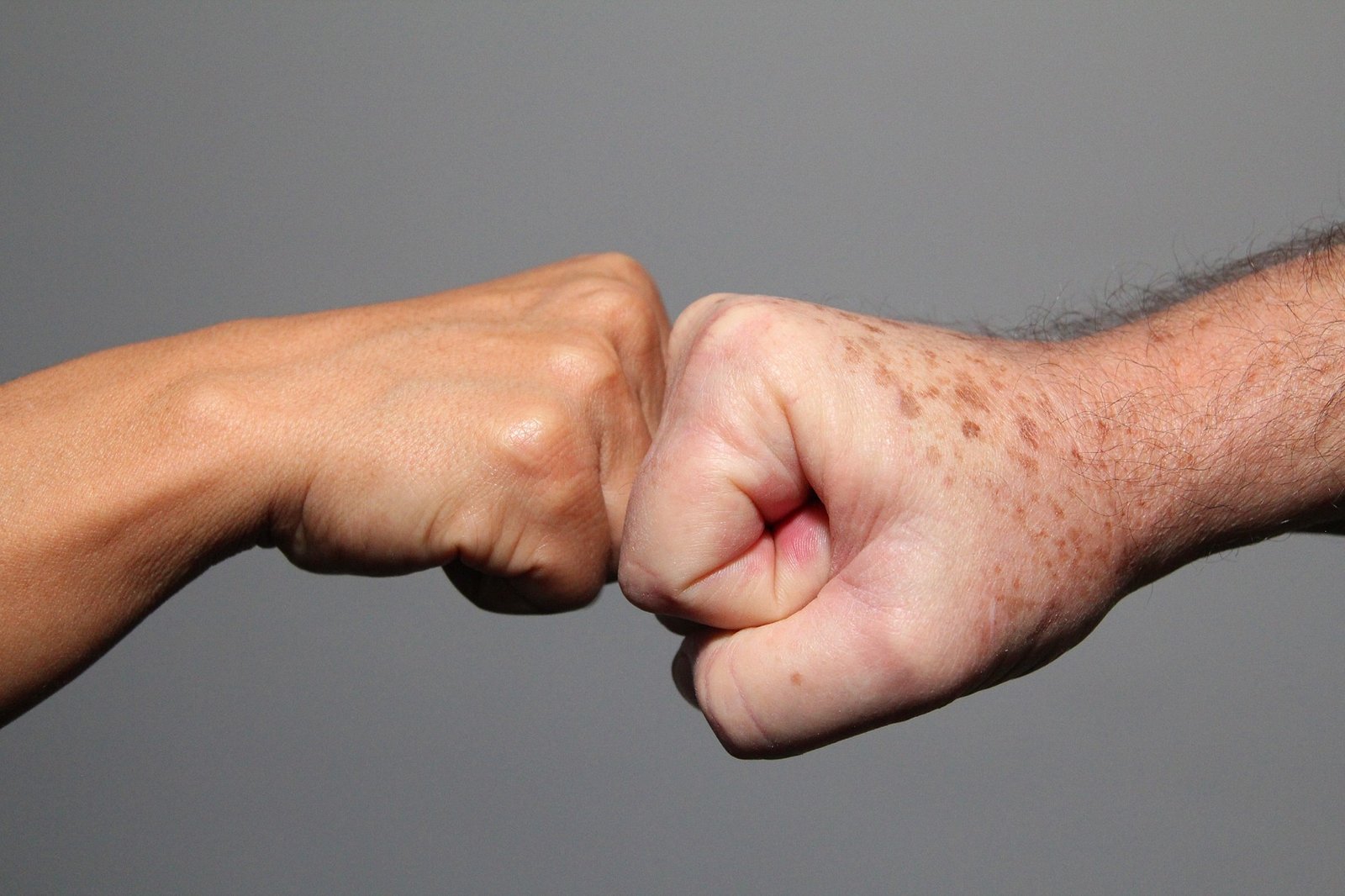 OPINIÃO | Preconceito “às claras”