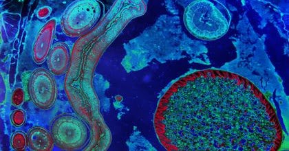 Alunos de Medicina Veterinária preparam materiais de divulgação de enfermidades parasitárias