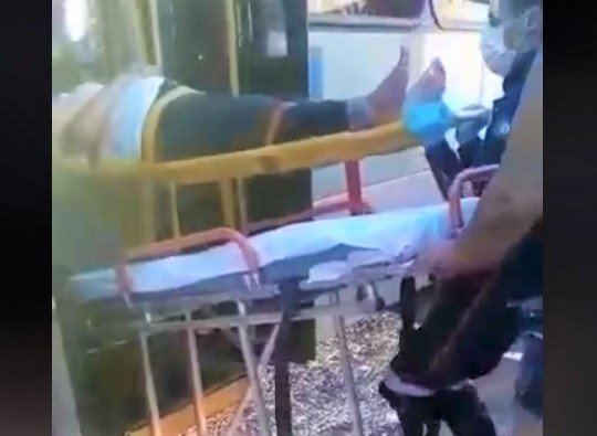 Botucatu: Mulher fica ferida após sofrer queda dentro de ônibus em alta velocidade