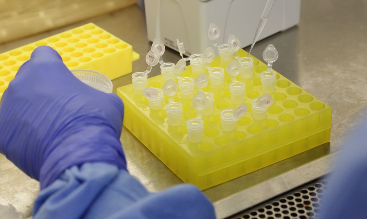 Botucatu chega a 40 casos positivos de Covid-19 com resultados de testes na comunidade