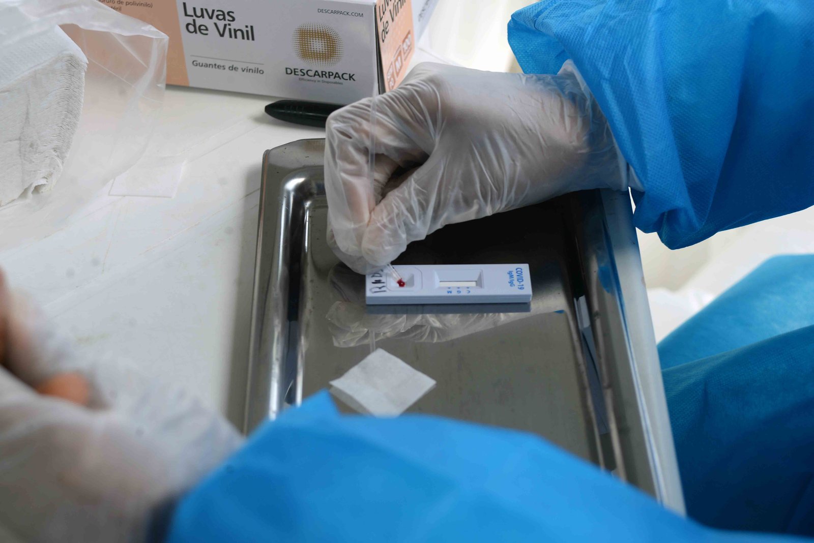 Botucatu contabiliza 384 casos confirmados de covid-19