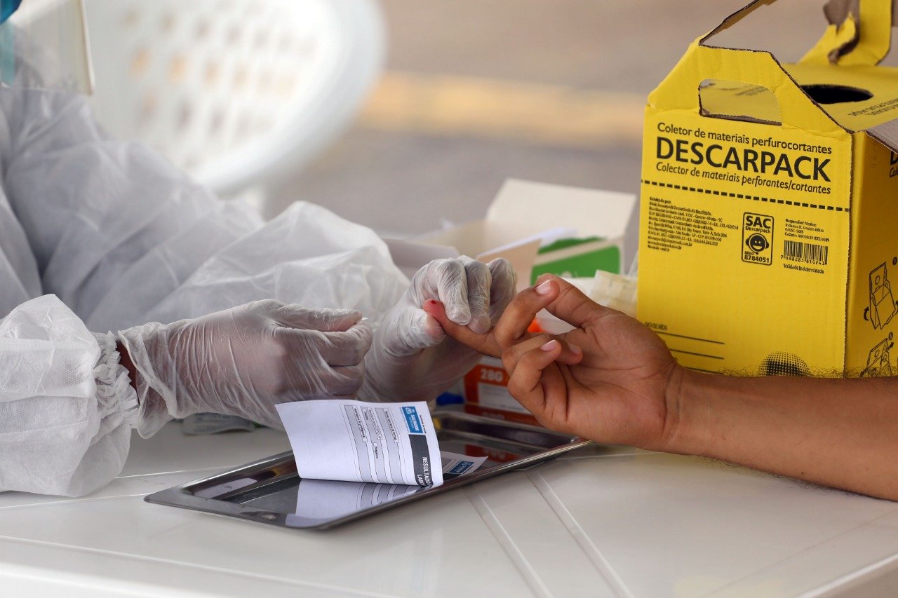 Botucatu chega a 321 casos positivos de Covid-19