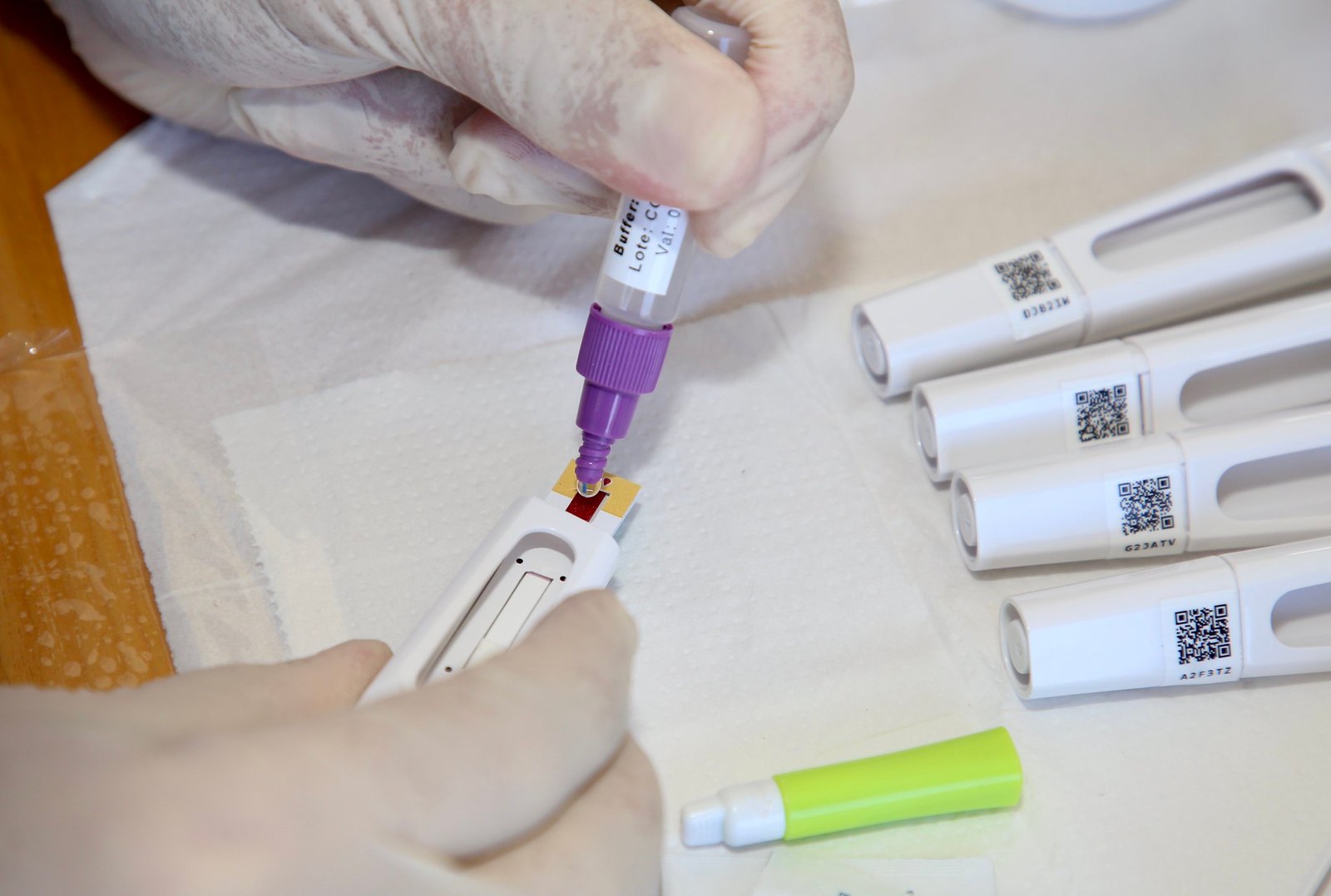 Botucatu chega a 158 casos confirmados de covid-19