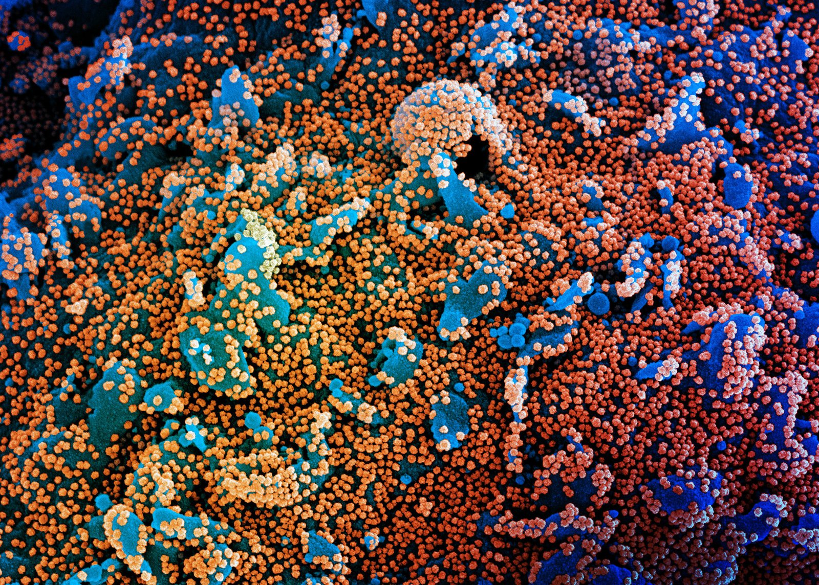 Covid-19: São Paulo poderá ter 20 mil óbitos até o fim de junho