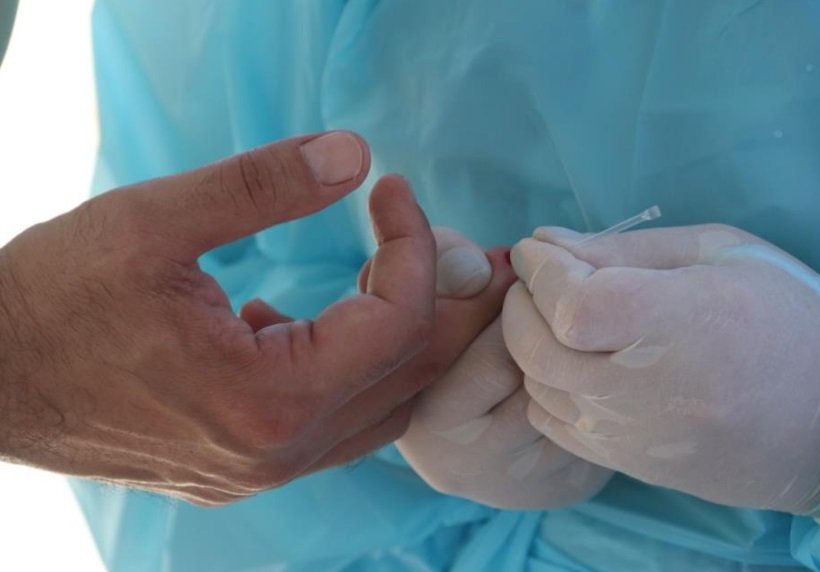 Botucatu ultrapassa a marca de 500 casos positivos de Covid-19