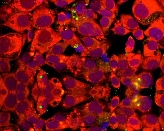 Estudo sugere que tecido adiposo pode servir de reservatório para o coronavírus
