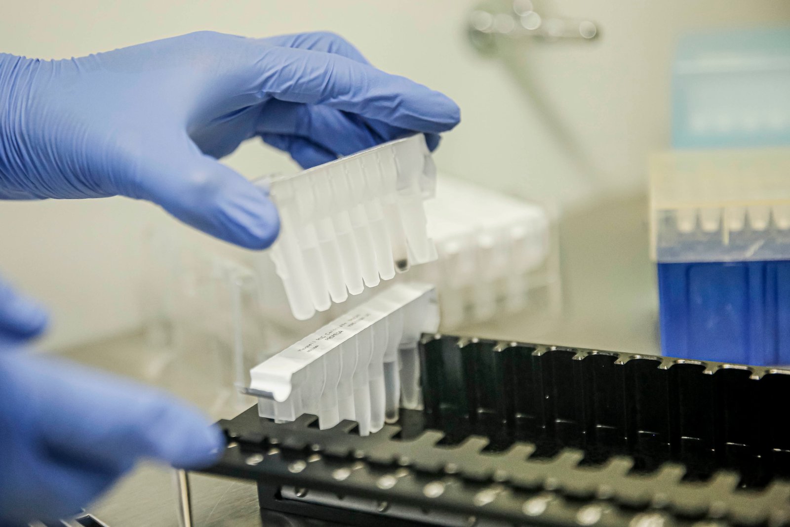 Covid-19: Botucatu apresenta a 4ª menor taxa entre municípios com mais de 100 mil habitantes