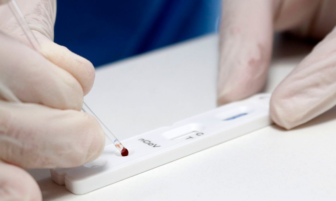 Botucatu confirma 143 casos de Covid-19 na semana, crescimento de 54% frente ao período anterior