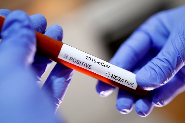 Fiocruz: pandemia mantém média de mil vítimas por dia no Brasil
