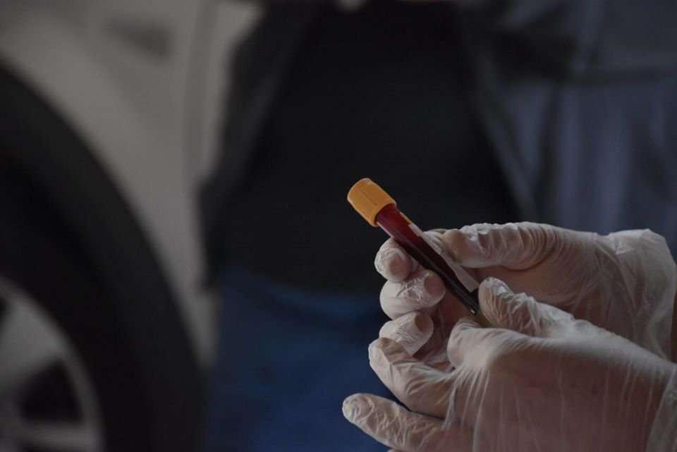 Avaré ultrapassa os 800 casos de covid-19