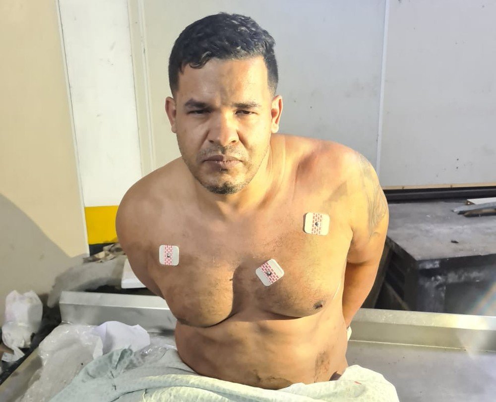 Suspeito de liderar ataque a banco em Botucatu é preso quando se preparava para fazer cirurgia em SP