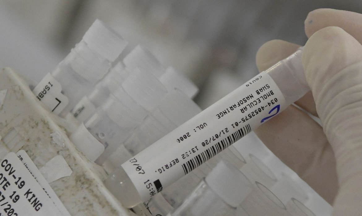 Botucatu confirma mais 62 casos de Covid-19 no sábado (9)