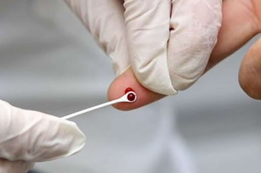 Campanha Fique Sabendo, contra HIV e Sífilis, começa nesta terça-feira, 1º de dezembro