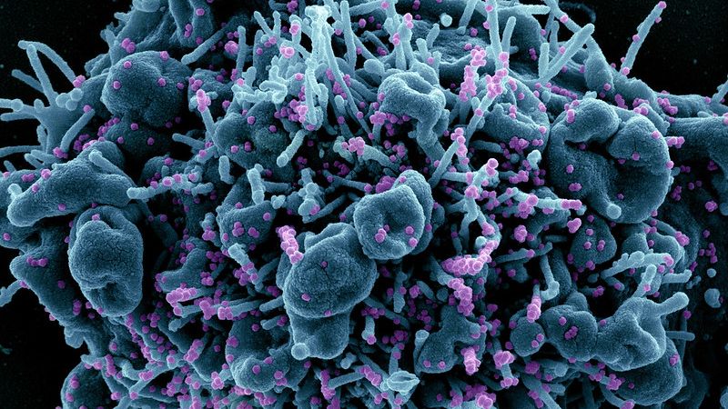 Sars-cov-2 inibe remoção de células mortas pelo sistema imune, favorecendo o dano pulmonar