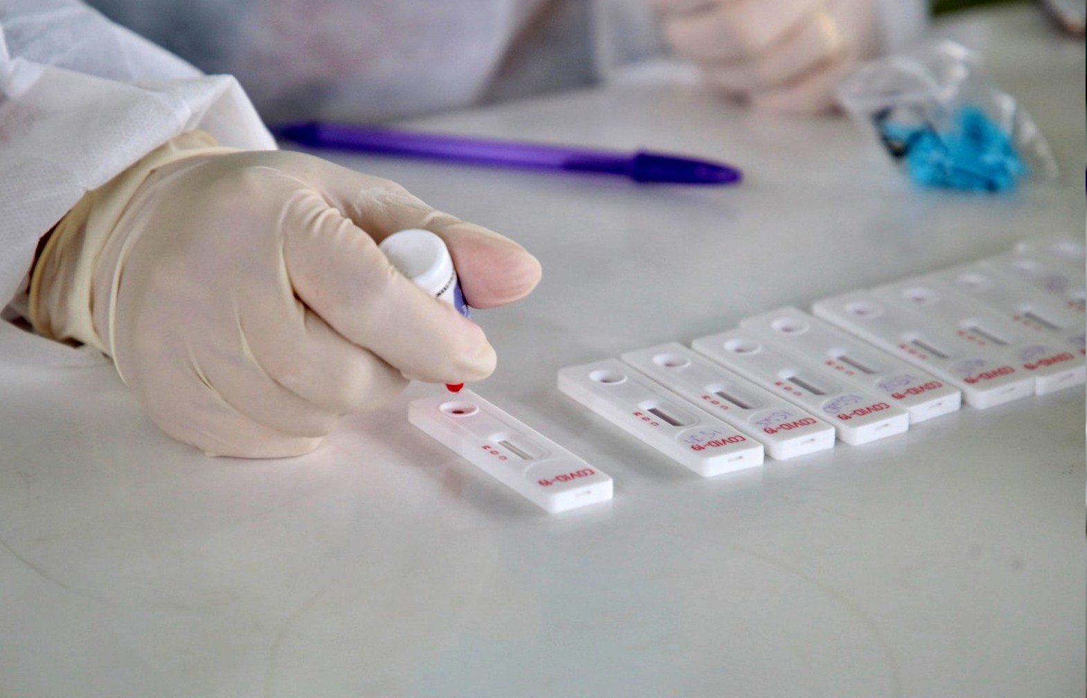 Covid-19: mais 84 novos casos são confirmados em Botucatu