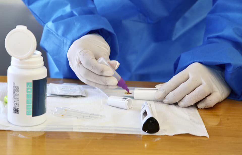 Secretaria de Saúde confirma 81 novos casos de Covid-19 em Botucatu;