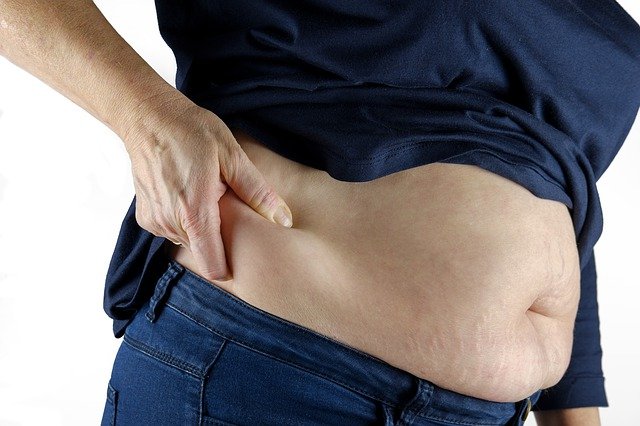 Gordura localizada nos quadris e coxa pode ser sintoma de lipedema