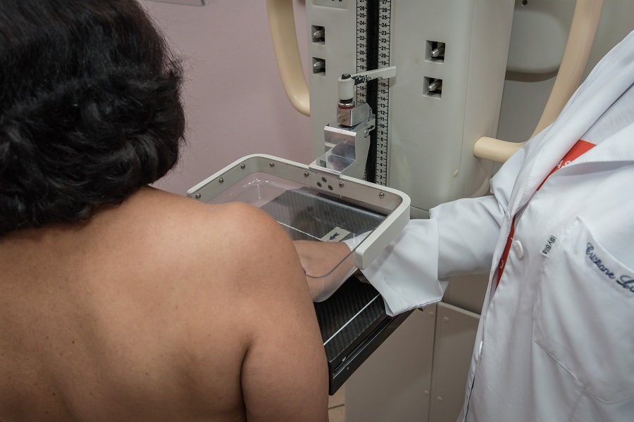 Botucatu abre agendamento para mamografias gratuitas