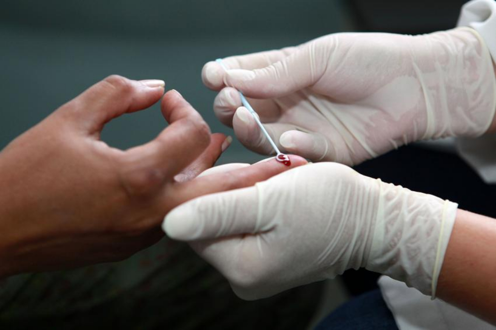 Secretaria de Saúde promoverá campanha de testagem de HIV e Sífilis