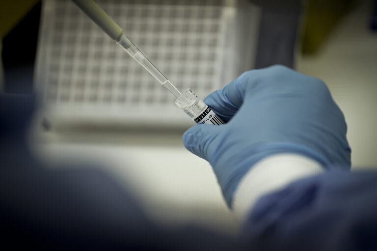Covid-19: Brasil registra 29,3 milhões de casos e 654 mil mortes