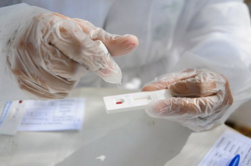 Botucatu terá teste combinado de Influenza e Covid-19
