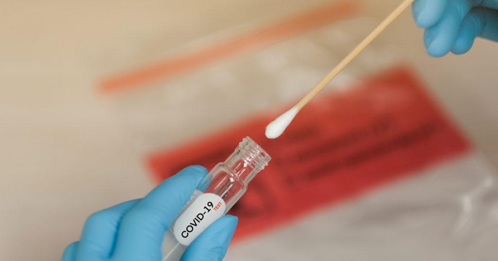 Mortes por covid-19 no Brasil chegam a 622,2 mil