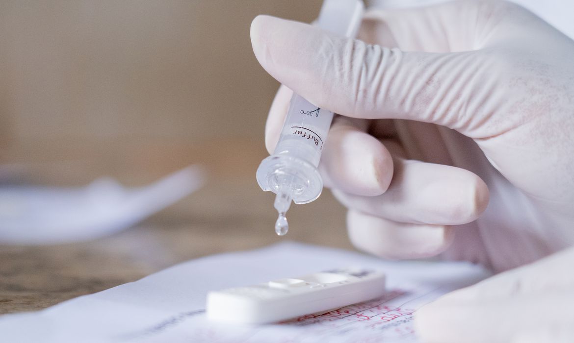 Covid-19: Brasil bate novo recorde de casos registrados em 24h