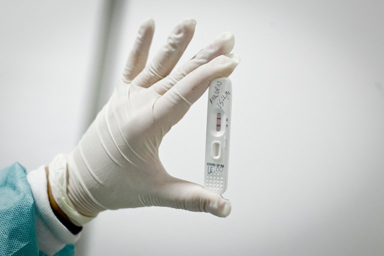 Botucatu encerra janeiro com 100 novos casos de Covid-19