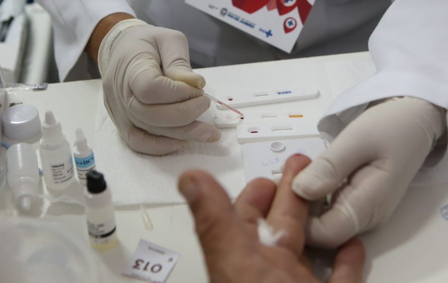 Botucatu reabrirá postos de testagens contra a Covid-19 aos finais de semana