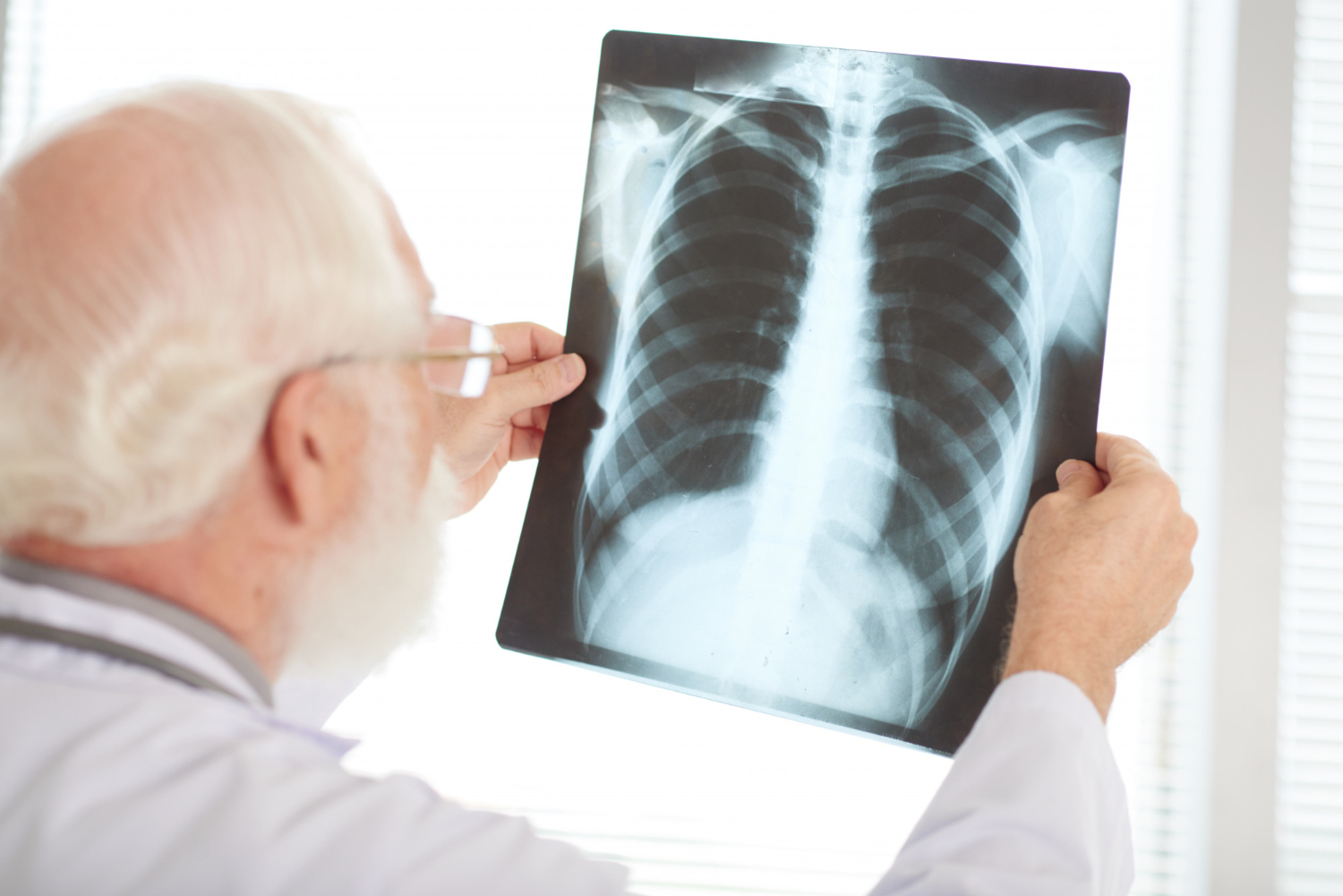 Dados da OMS mostram que o Brasil é o segundo país no mundo em mortes por tuberculose