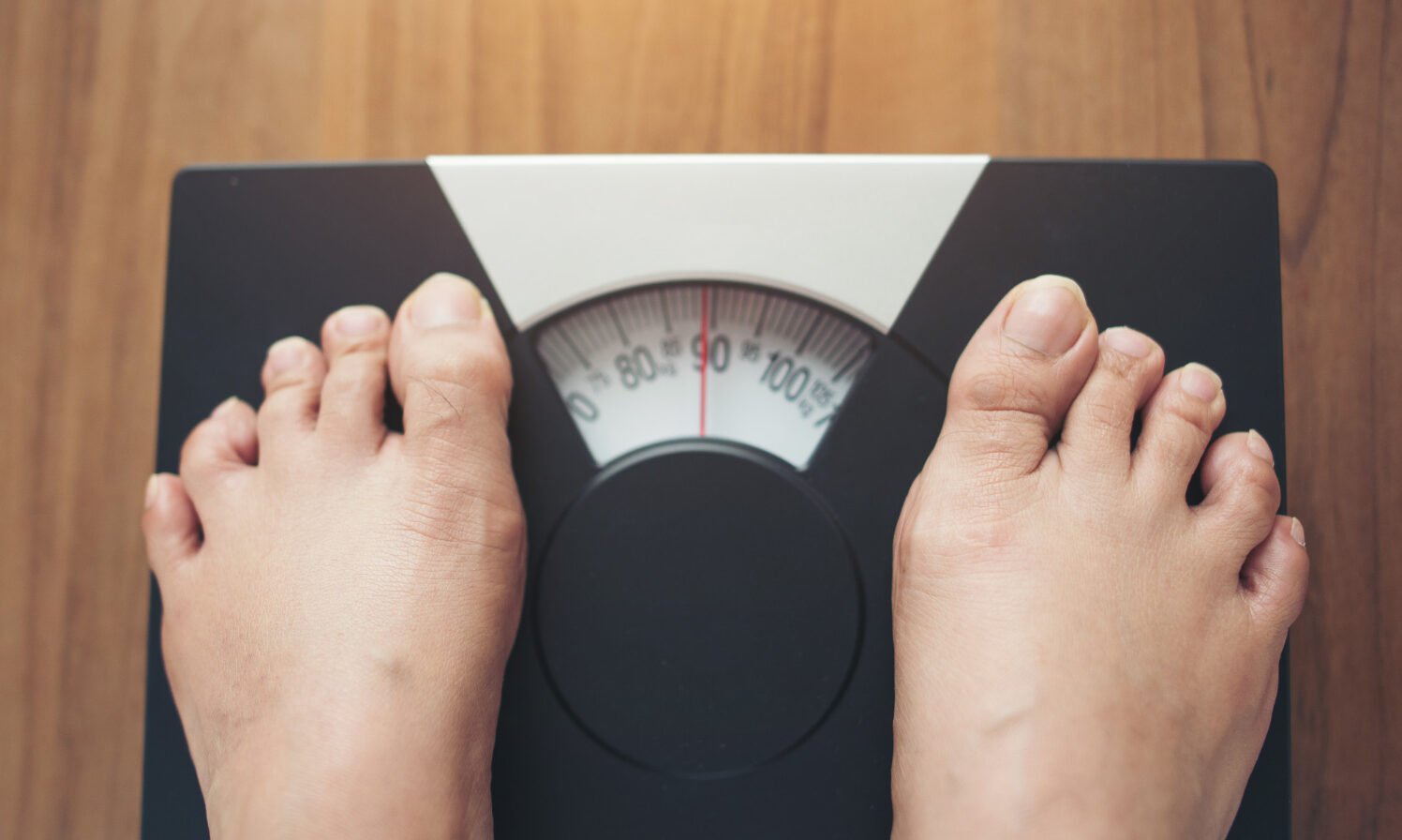 Médicos propõem nova classificação da obesidade com base na perda percentual de peso