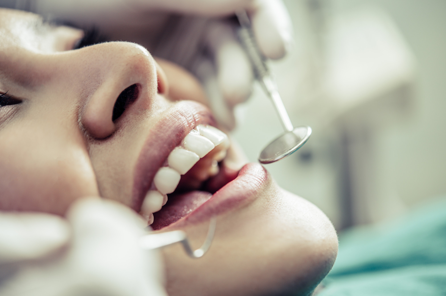 Câncer de boca: quais os sintomas e como prevenir?