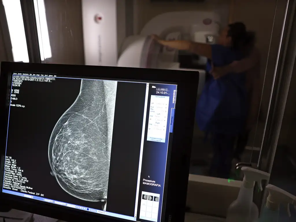 Sancionada lei que garante mamografia pelo SUS a mulheres a partir de 40 anos