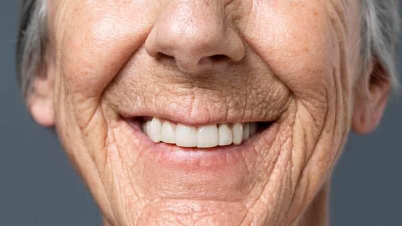 Perda de dentes em idosos piora a saúde e aumenta risco de morte
