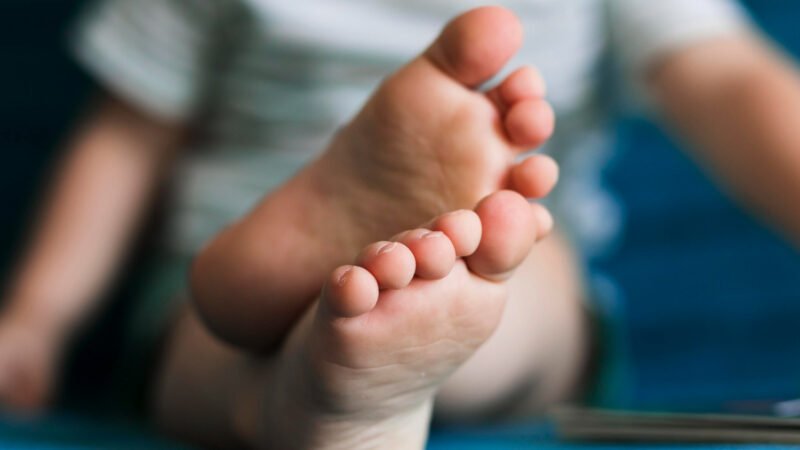 Doença rara, fenilcetonúria ganha tratamento inédito no Brasil