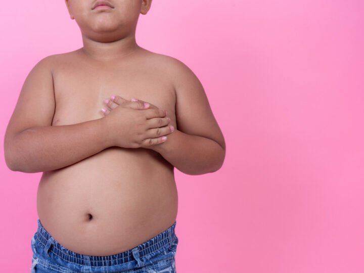 Sem controle, obesidade na infância tende a se manter na adolescência