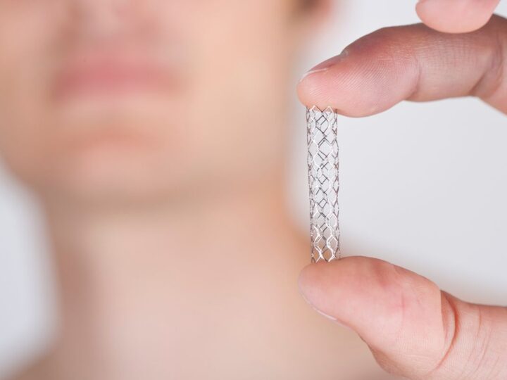 Nova técnica pode desobstruir artérias calcificadas sem uso de stent